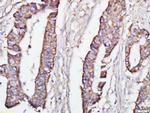 DEPTOR Antibody in Immunohistochemistry (Paraffin) (IHC (P))