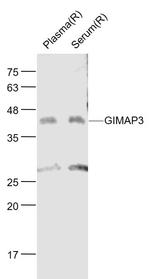 GIMAP3 Antibody in Western Blot (WB)