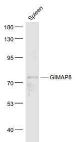 GIMAP8 Antibody in Western Blot (WB)