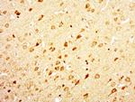 DIRC2 Antibody in Immunohistochemistry (Paraffin) (IHC (P))