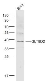 GLT8D2 Antibody in Western Blot (WB)