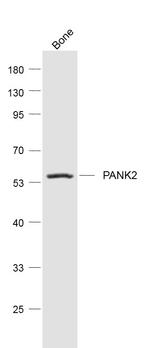 PANK2 Antibody in Western Blot (WB)