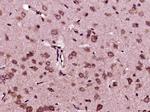 SUMO-1 Antibody in Immunohistochemistry (Paraffin) (IHC (P))