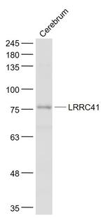 LRRC41 Antibody in Western Blot (WB)