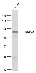 LRRC41 Antibody in Western Blot (WB)