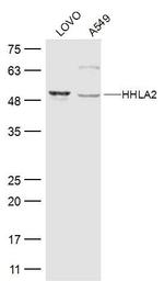 HHLA2 Antibody in Western Blot (WB)