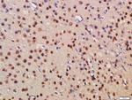 BRD1 Antibody in Immunohistochemistry (Paraffin) (IHC (P))