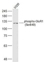 Phospho-GluR1 (Ser849) Antibody in Western Blot (WB)