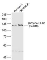 Phospho-GluR1 (Ser849) Antibody in Western Blot (WB)
