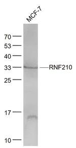 RNF210 Antibody in Western Blot (WB)