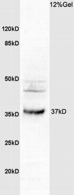OSTM1 Antibody in Western Blot (WB)