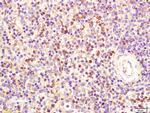 FCER1A Antibody in Immunohistochemistry (Paraffin) (IHC (P))