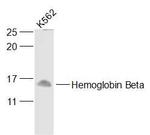 HBB + HBD Antibody in Western Blot (WB)