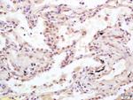 Ubiquityl-Histone H2A.X (Lys119) Antibody in Immunohistochemistry (Paraffin) (IHC (P))
