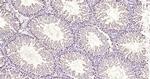 Ubiquityl-Histone H2A.X (Lys119) Antibody in Immunohistochemistry (Paraffin) (IHC (P))