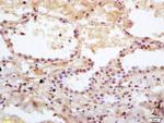 DHRS2 Antibody in Immunohistochemistry (Paraffin) (IHC (P))