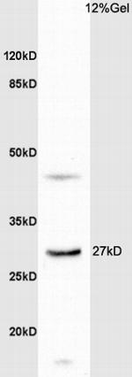 DHRS2 Antibody in Western Blot (WB)