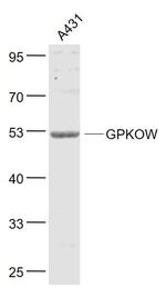GPKOW Antibody in Western Blot (WB)