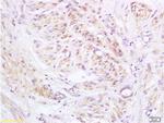 PXMP1 Antibody in Immunohistochemistry (Paraffin) (IHC (P))