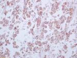 Arginase 1 Antibody in Immunohistochemistry (Paraffin) (IHC (P))