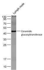 UGCG Antibody in Western Blot (WB)