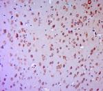Phospho-PKC Epsilon (Ser729) Antibody in Immunohistochemistry (Paraffin) (IHC (P))