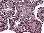 Cdc14A Antibody in Immunohistochemistry (Paraffin) (IHC (P))