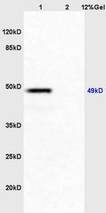 HNF3 alpha Antibody in Western Blot (WB)