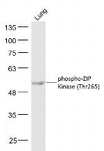 Phospho-ZIP Kinase (Thr265) Antibody in Western Blot (WB)