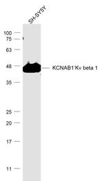 KCNAB1 Antibody in Western Blot (WB)