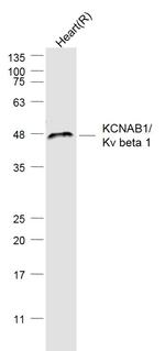 KCNAB1 Antibody in Western Blot (WB)
