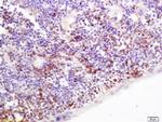 CD36 Antibody in Immunohistochemistry (Paraffin) (IHC (P))