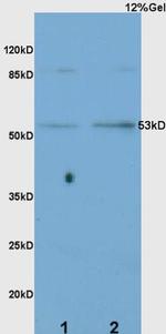 CD36 Antibody in Western Blot (WB)