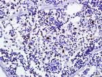 IFNA1 Antibody in Immunohistochemistry (Paraffin) (IHC (P))