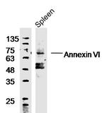 Annexin VI Antibody in Western Blot (WB)