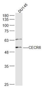 CECR6 Antibody in Western Blot (WB)