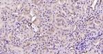 AKAP2 Antibody in Immunohistochemistry (Paraffin) (IHC (P))