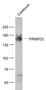 PDZK4 Antibody in Western Blot (WB)