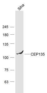 PDZD6 Antibody in Western Blot (WB)