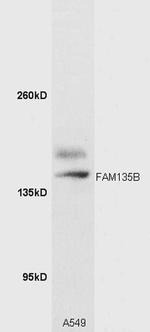 FAM135B Antibody in Western Blot (WB)