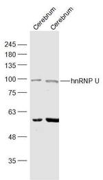 hnRNP U Antibody in Western Blot (WB)