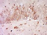 AGXT2L2 Antibody in Immunohistochemistry (Paraffin) (IHC (P))