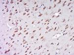 AER61 Antibody in Immunohistochemistry (Paraffin) (IHC (P))