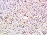 ATAD2 Antibody in Immunohistochemistry (Paraffin) (IHC (P))