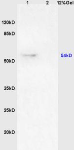 CSN1 Antibody in Western Blot (WB)