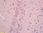 TTC33 Antibody in Immunohistochemistry (Paraffin) (IHC (P))