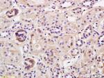 TRIM41 Antibody in Immunohistochemistry (Paraffin) (IHC (P))