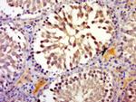 RNF17 Antibody in Immunohistochemistry (Paraffin) (IHC (P))