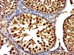 RNF6 Antibody in Immunohistochemistry (Paraffin) (IHC (P))