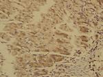 MTM1 Antibody in Immunohistochemistry (Paraffin) (IHC (P))